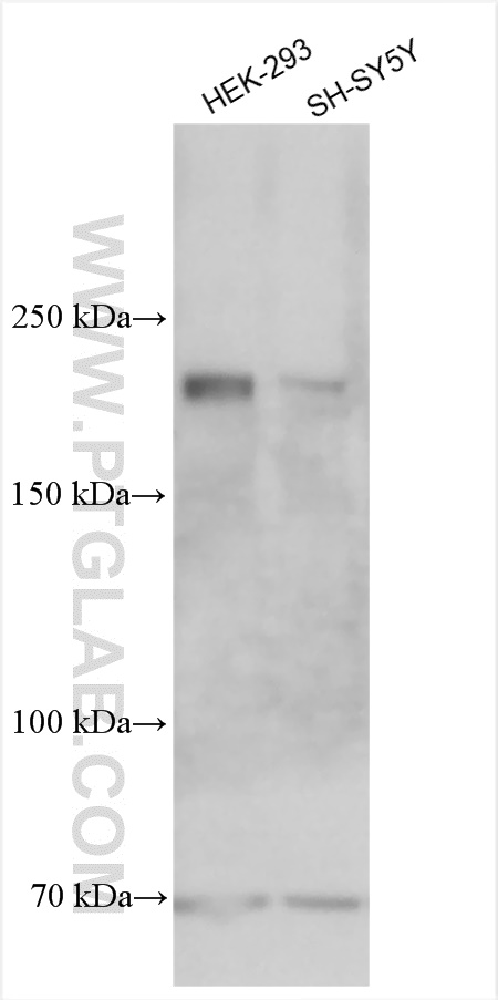 WB analysis using 19143-1-AP