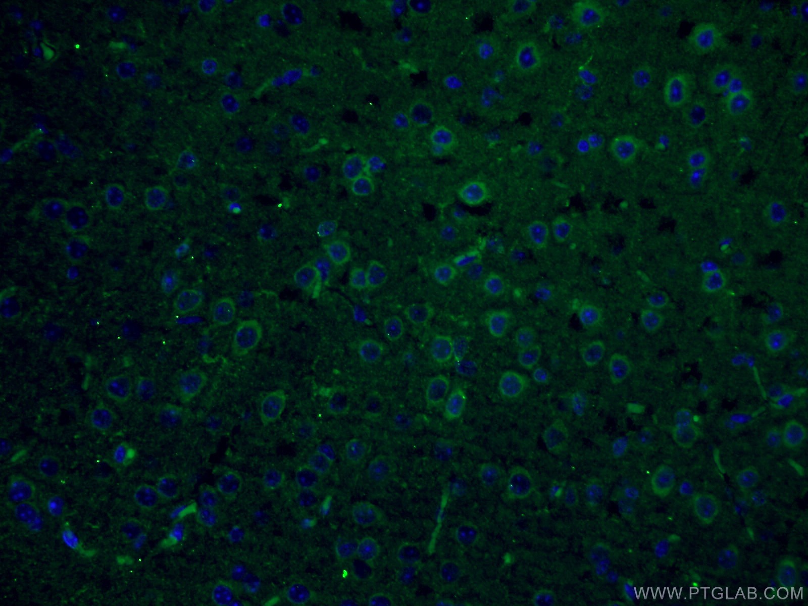 IF Staining of mouse brain using 17421-1-AP