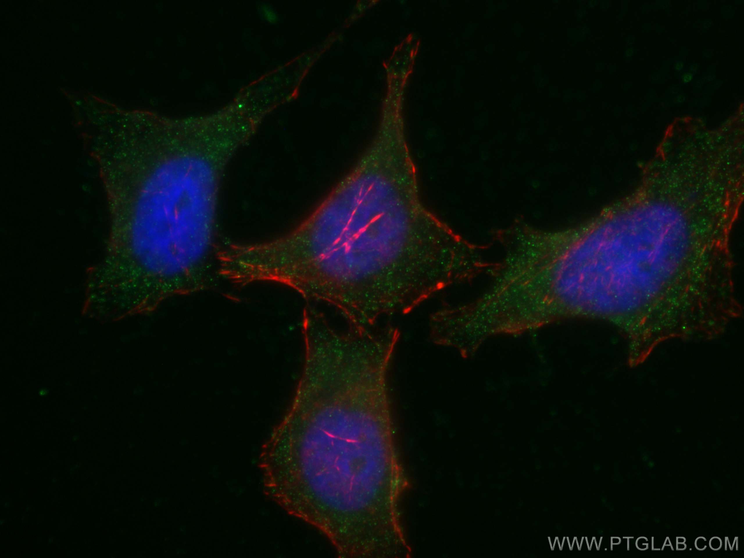 IF Staining of HeLa using 67471-1-Ig