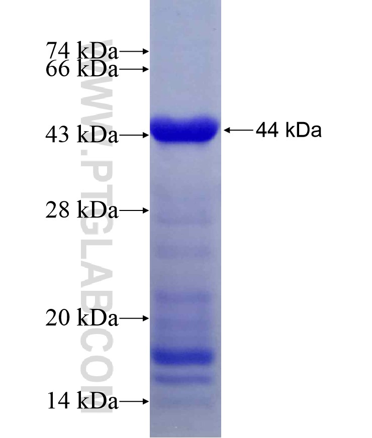 PLCL2 fusion protein Ag11461 SDS-PAGE