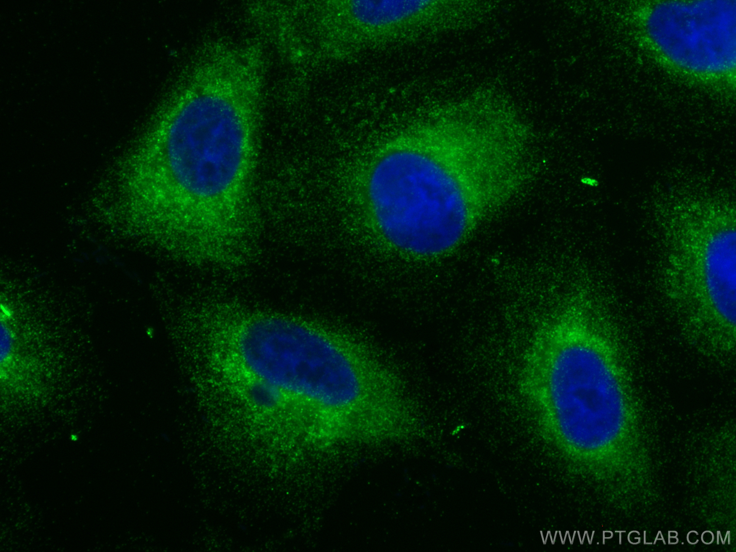 IF Staining of A549 using 20161-1-AP