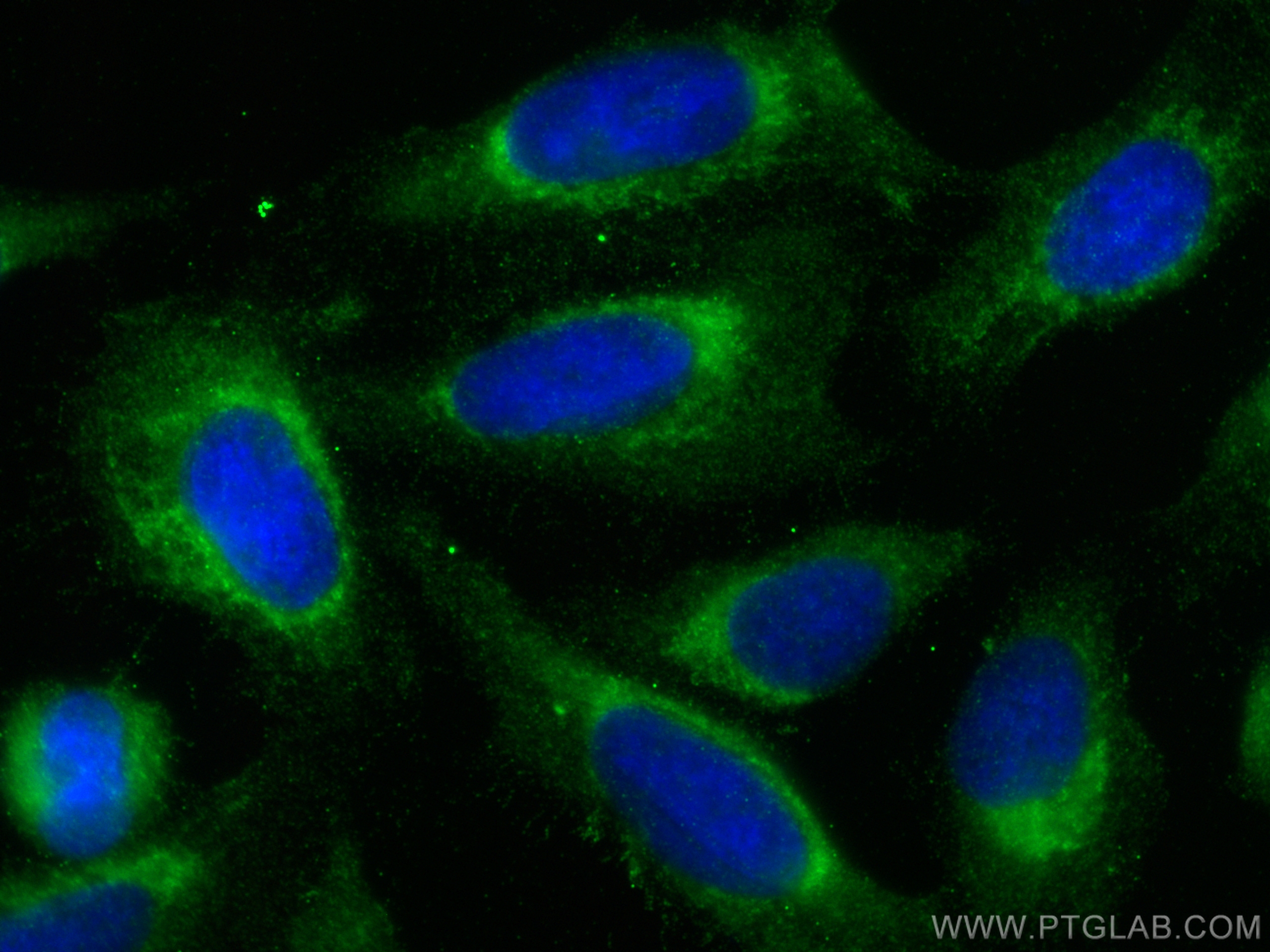 IF Staining of U2OS using 20161-1-AP