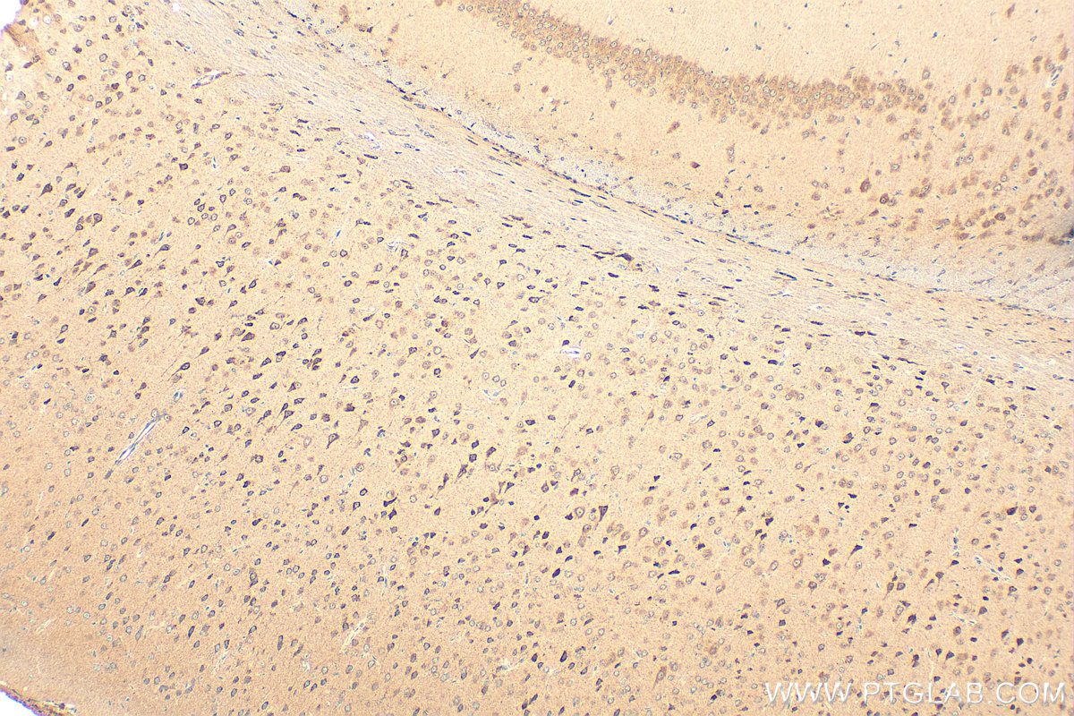 IHC staining of mouse brain using 20161-1-AP