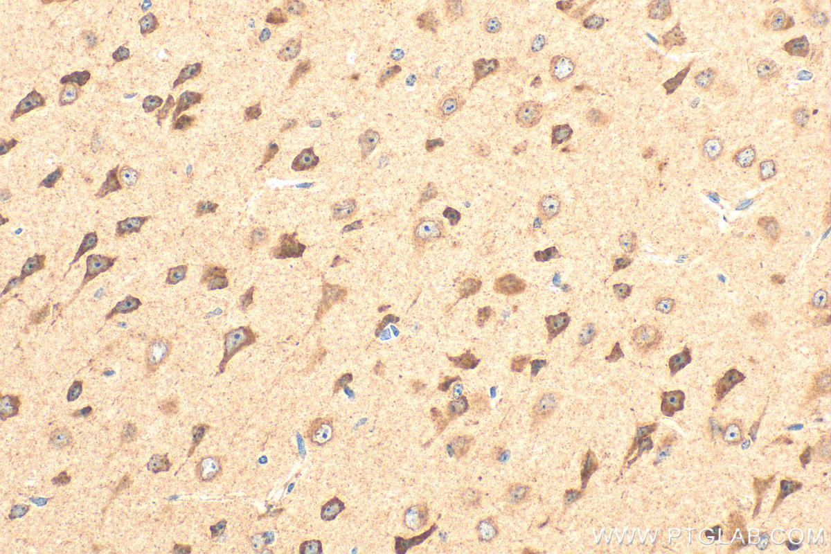 IHC staining of mouse brain using 20161-1-AP