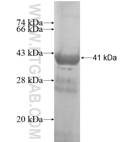 PLCXD1 fusion protein Ag15101 SDS-PAGE