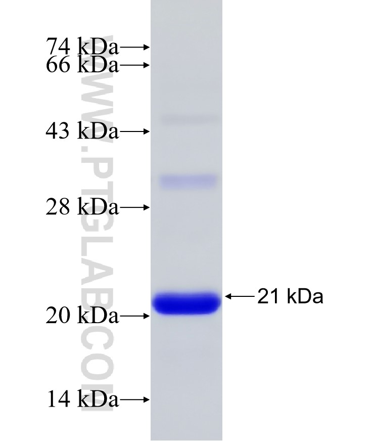 PLCXD2 fusion protein Ag27647 SDS-PAGE