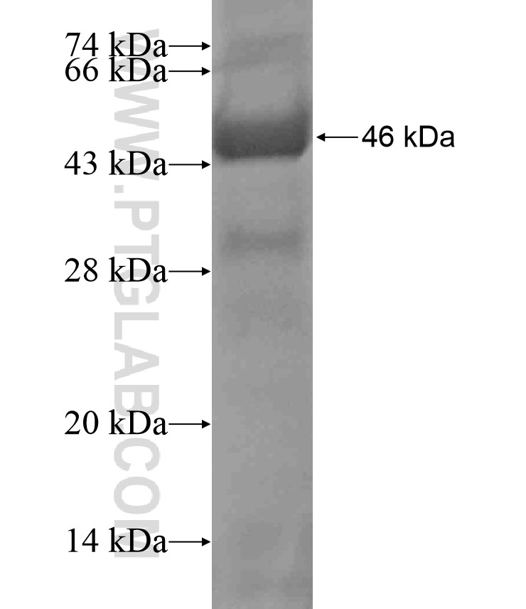 PLCZ1 fusion protein Ag17849 SDS-PAGE PLCZ1 fusion protein Ag17849 SDS-PAGE