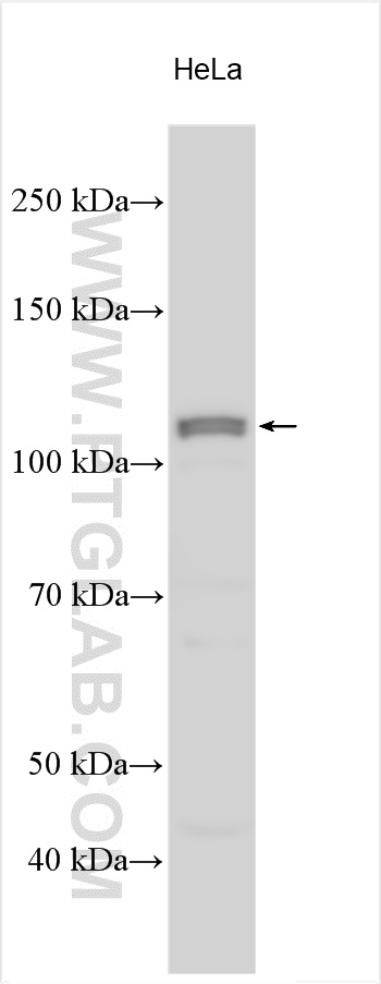 WB analysis using 18355-1-AP