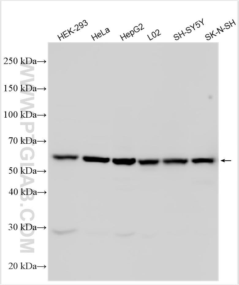 Various lysates were subjected to SDS PAGE followed by western blot with 17327-1-AP (PLD3 antibody) at dilution of 1:2000 incubated at room temperature for 1.5 hours. WB analysis using 17327-1-AP