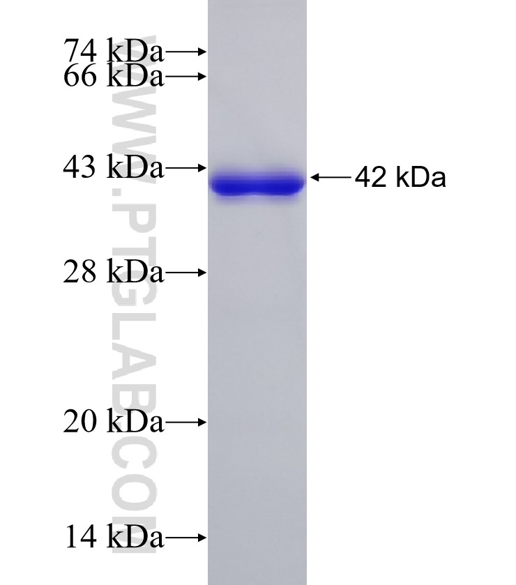 PLEC fusion protein Ag33738 SDS-PAGE PLEC fusion protein Ag33738 SDS-PAGE