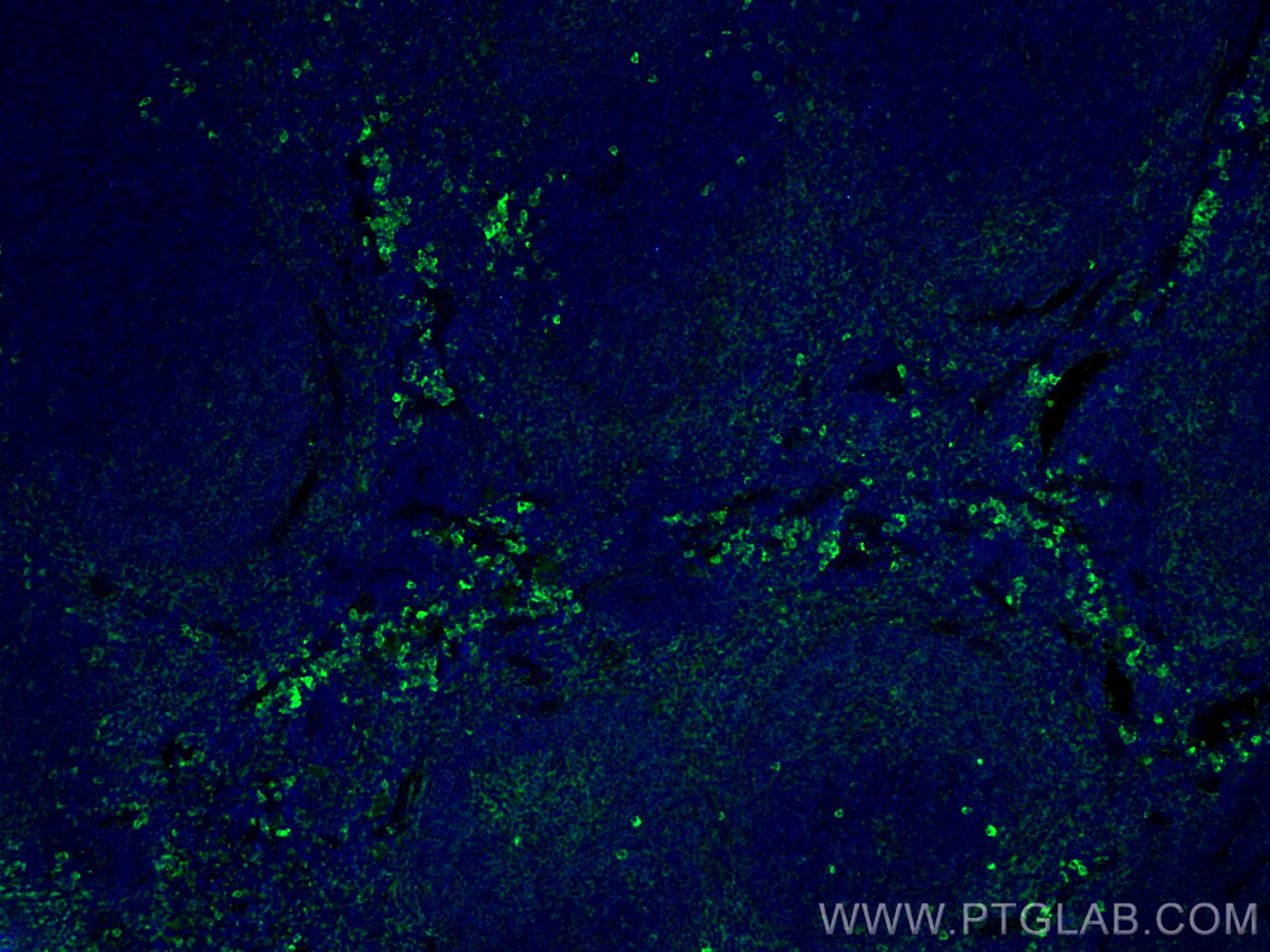 IF Staining of mouse spleen using 66431-1-Ig (same clone as 66431-1-PBS)