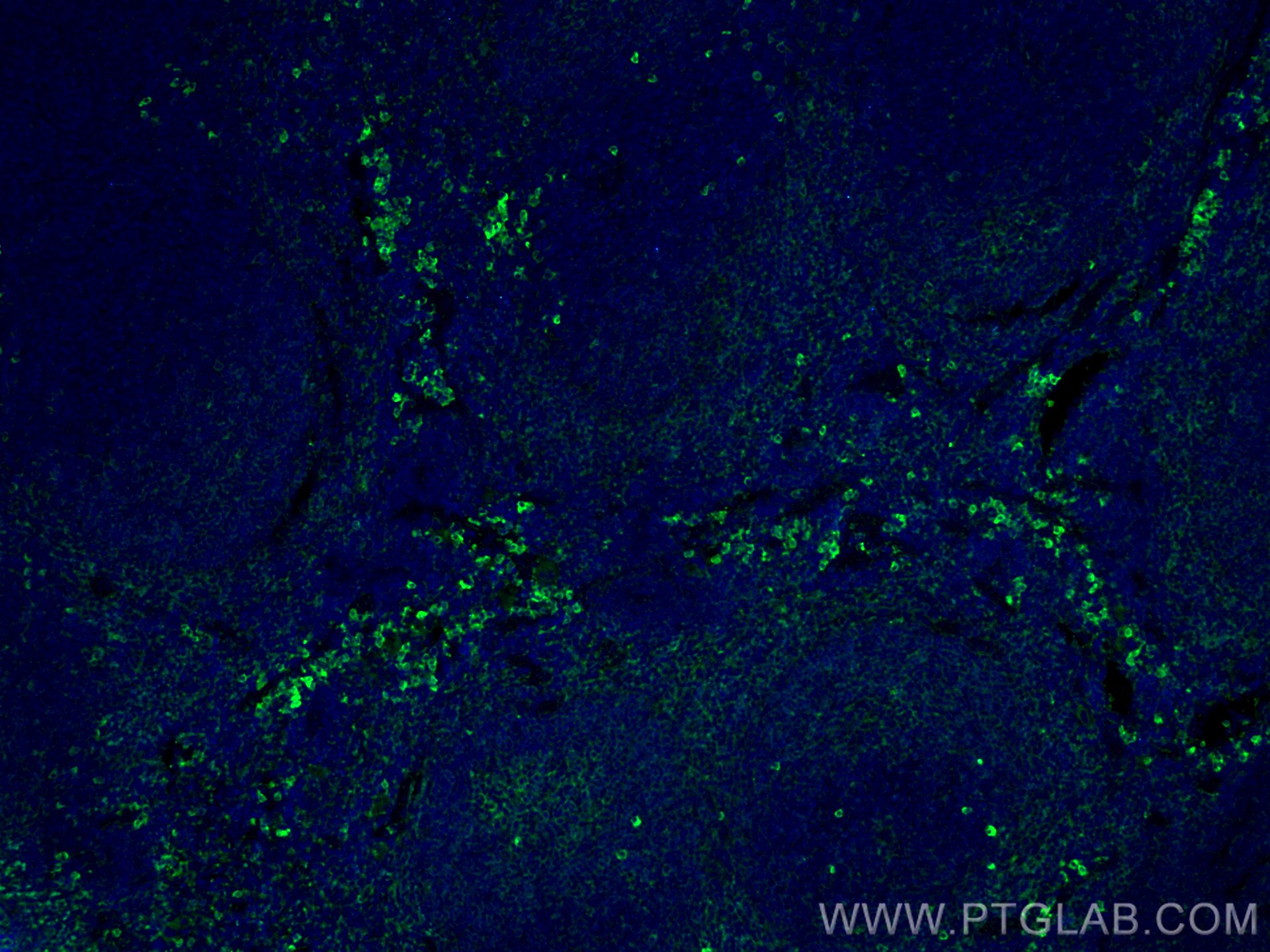 IF Staining of mouse spleen using 66431-1-Ig