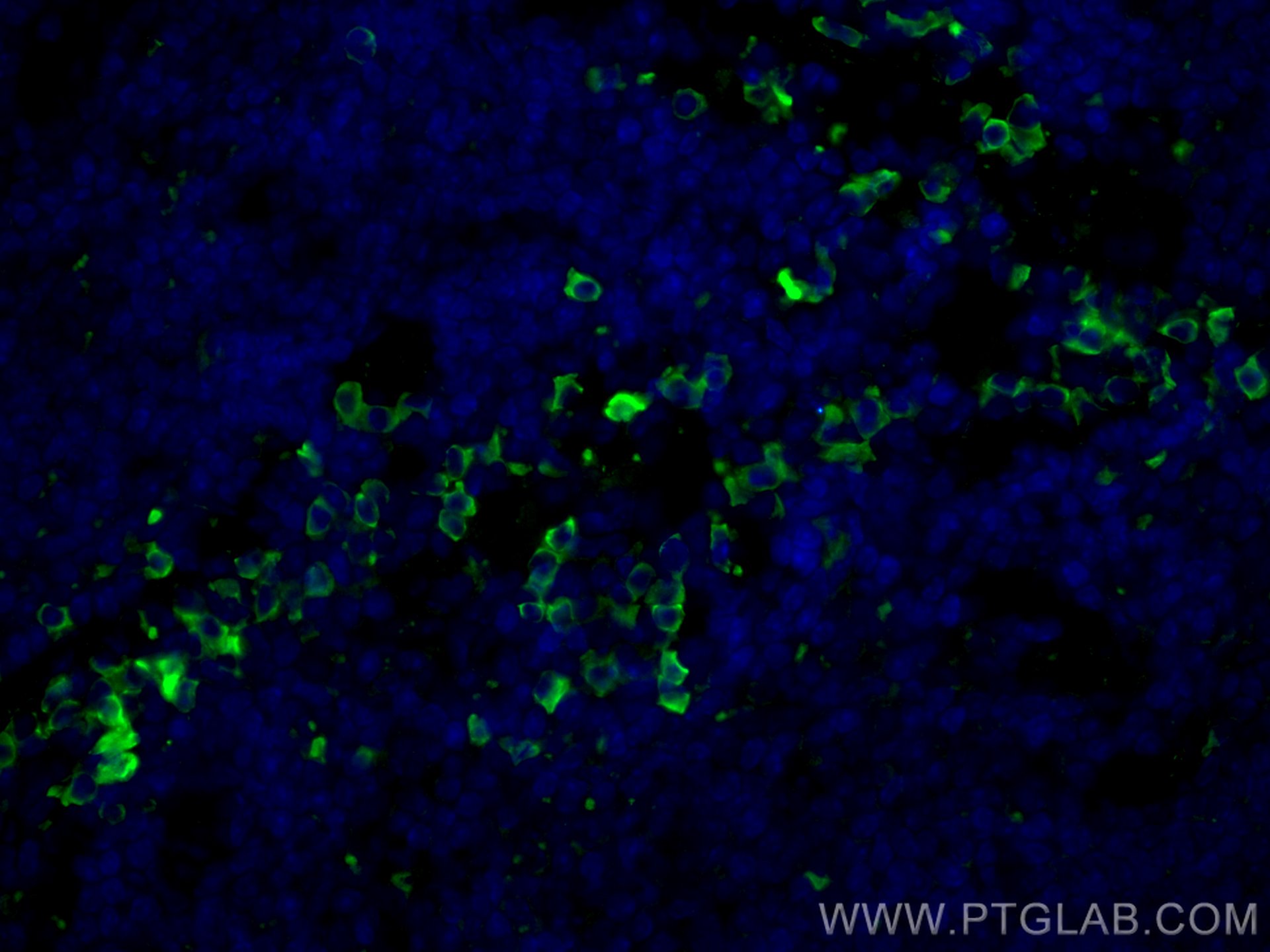 IF Staining of mouse spleen using 66431-1-Ig (same clone as 66431-1-PBS)