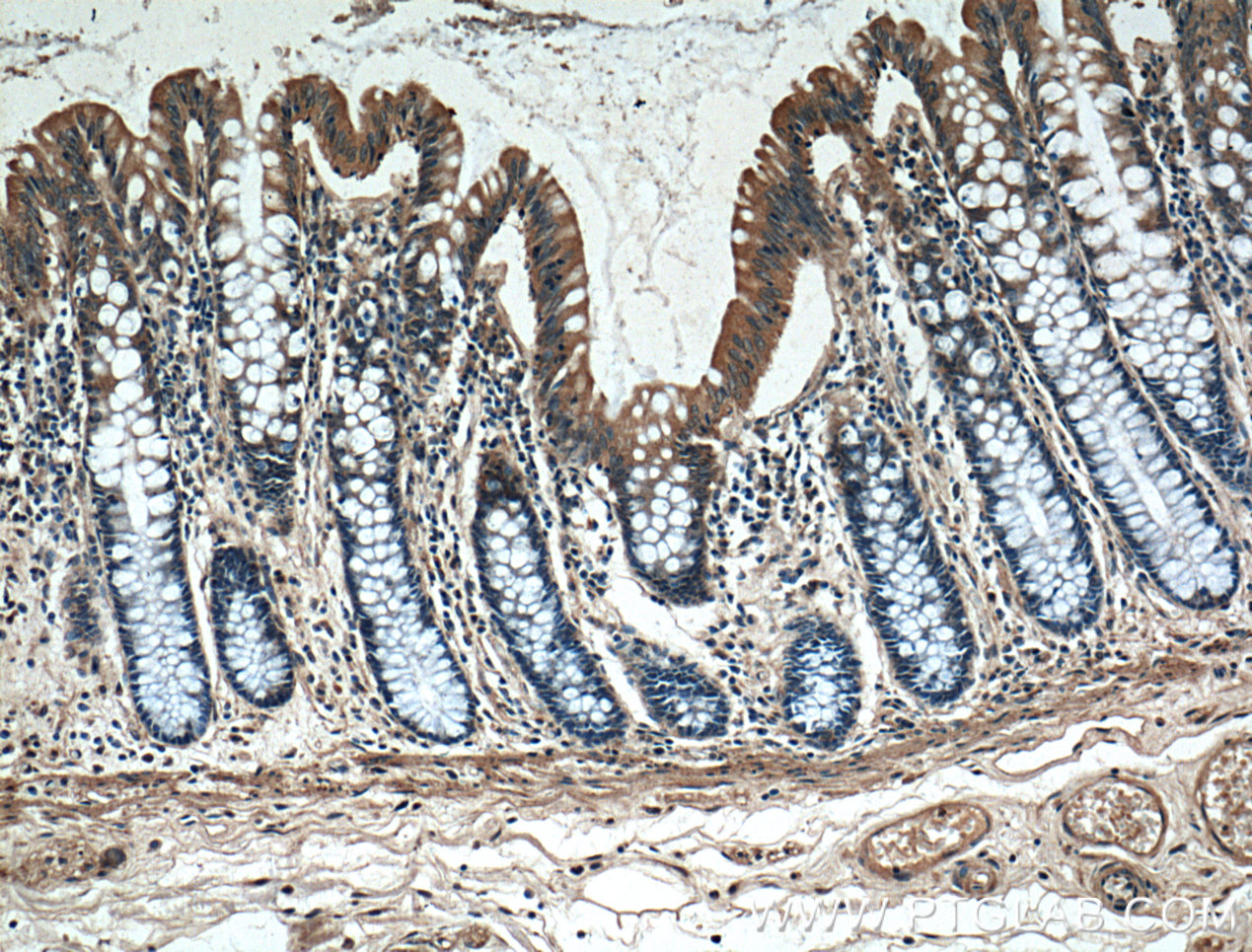 IHC staining of human colon using 10238-1-AP