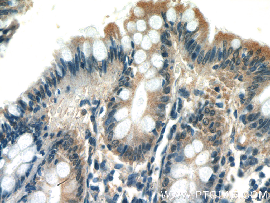 IHC staining of human colon using 26830-1-AP