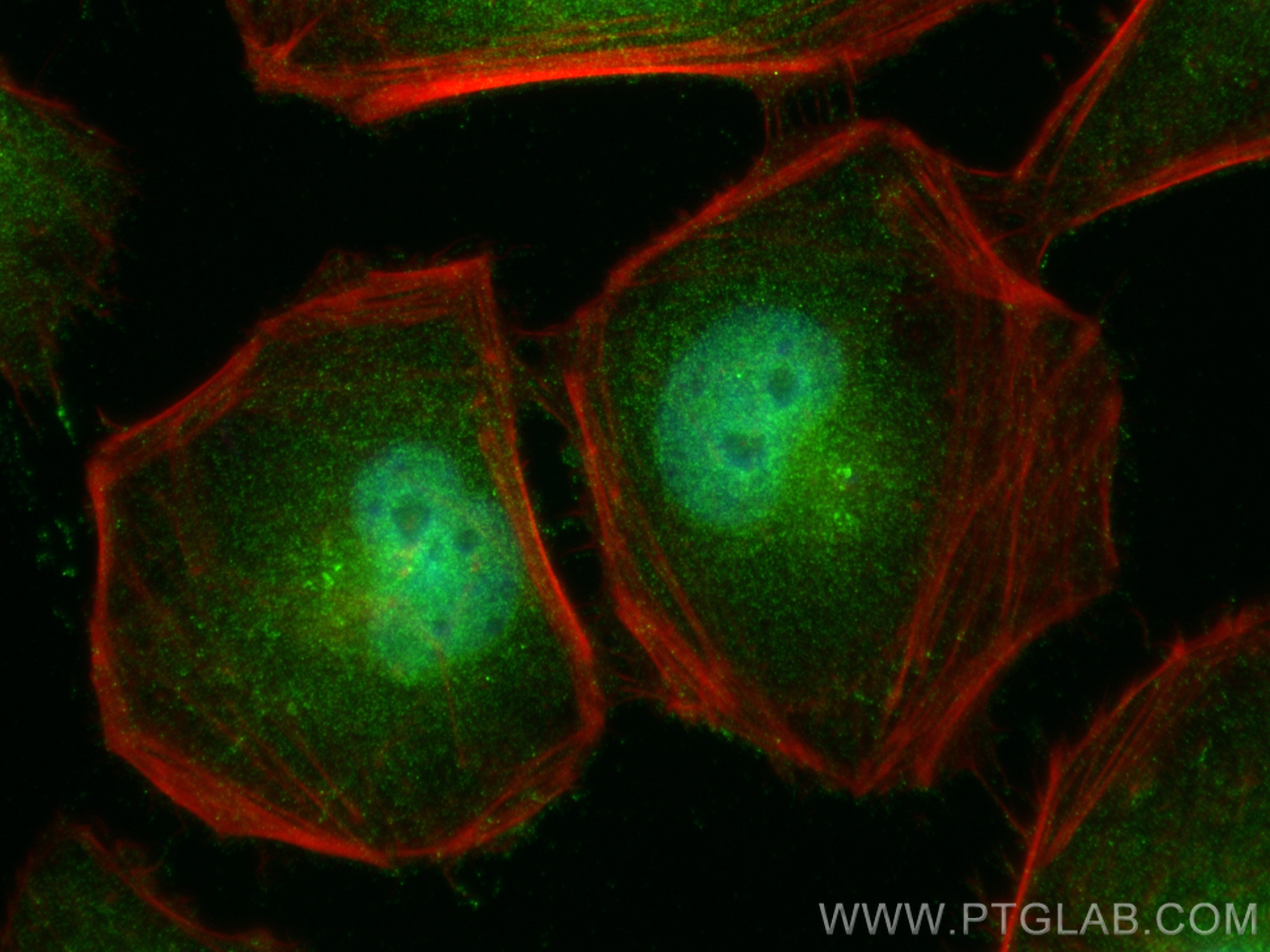 IF Staining of HeLa using 32169-1-AP