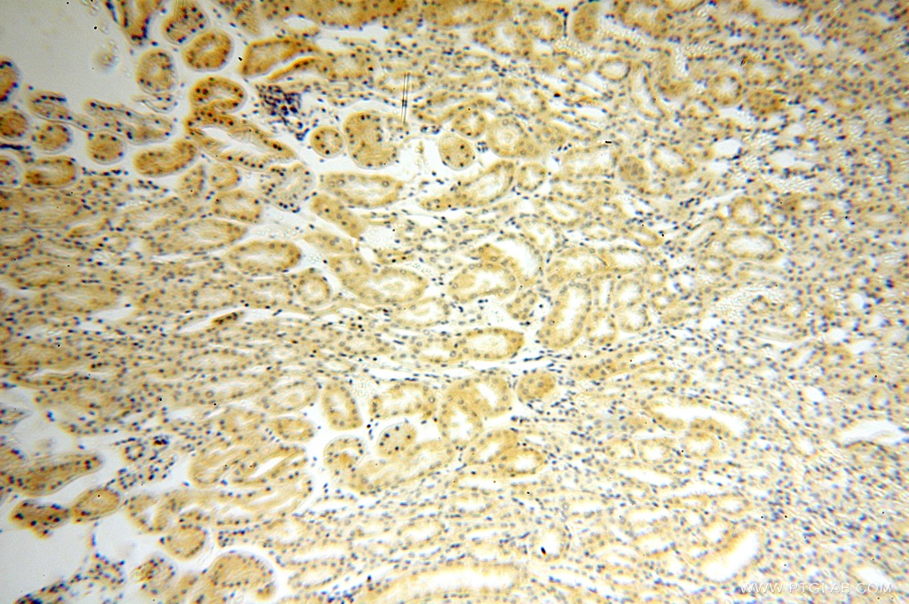IHC staining of human kidney using 15410-1-AP