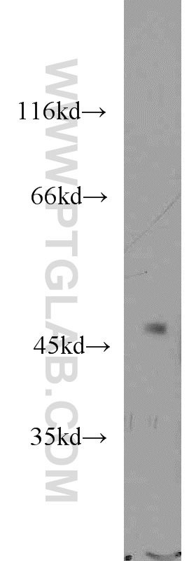 WB analysis of mouse brain using 15410-1-AP