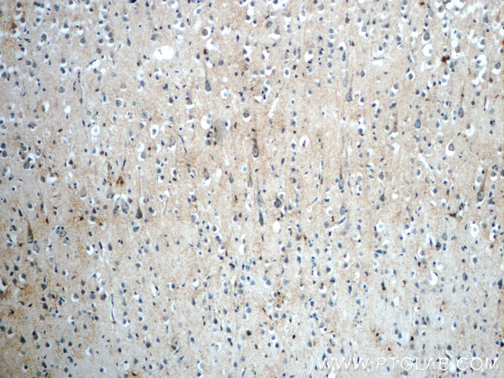 IHC staining of human brain using 20389-1-AP