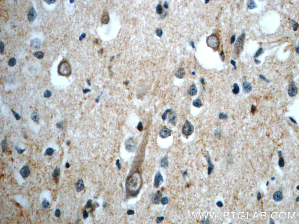 IHC staining of human brain using 20389-1-AP