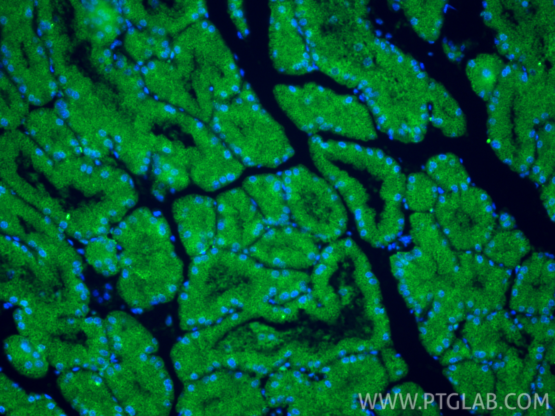 Immunofluorescent analysis of (4% PFA) fixed paraffin-embedded mouse brown adipose tissue using PLEKHF2 antibody (25424-1-AP) at dilution of 1:400 and CoraLite®488-Conjugated Goat Anti-Rabbit IgG(H+L) (<a class='green' href='/productredirect?CatalogNo=SA00013-2' target='_blank'>SA00013-2</a>). Heat mediated antigen retrieval with Tris-EDTA buffer (pH 9.0). IF Staining of mouse brown adipose using 25424-1-AP