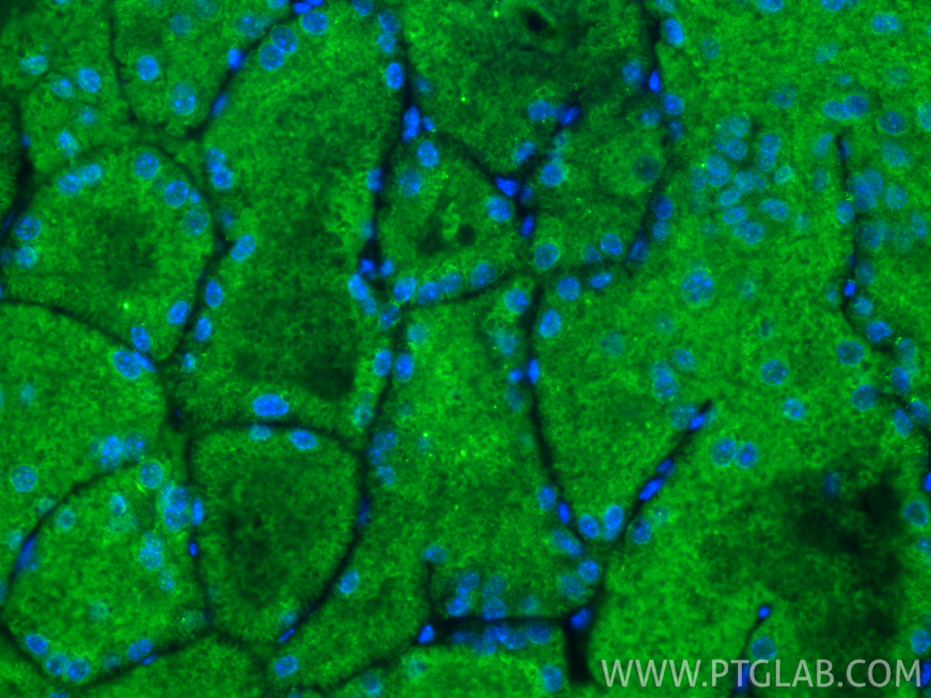 Immunofluorescent analysis of (4% PFA) fixed paraffin-embedded mouse brown adipose tissue using PLEKHF2 antibody (25424-1-AP) at dilution of 1:400 and CoraLite®488-Conjugated Goat Anti-Rabbit IgG(H+L) (<a class='green' href='/productredirect?CatalogNo=SA00013-2' target='_blank'>SA00013-2</a>). Heat mediated antigen retrieval with Tris-EDTA buffer (pH 9.0). IF Staining of mouse brown adipose using 25424-1-AP