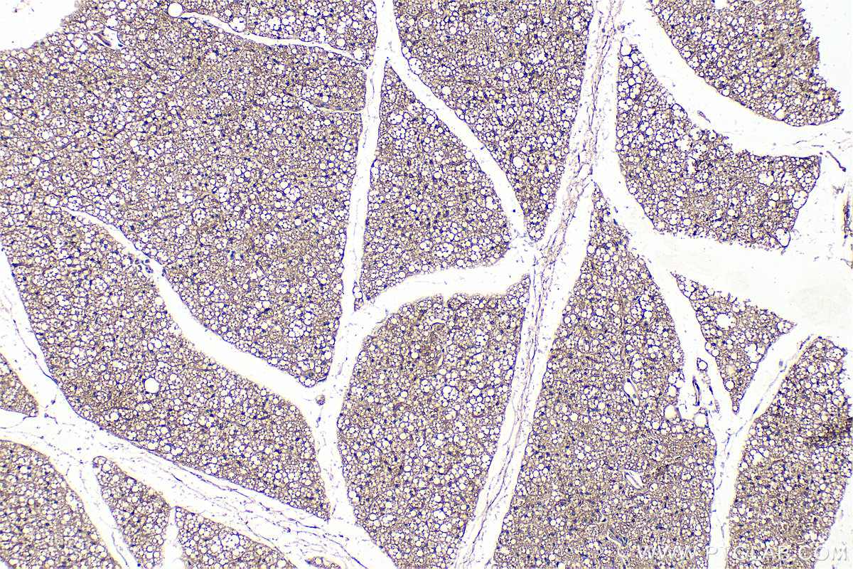 Immunohistochemical analysis of paraffin-embedded mouse brown adipose tissue slide using 25424-1-AP (PLEKHF2 antibody) at dilution of 1:300 (under 10x lens). Heat mediated antigen retrieval with Tris-EDTA buffer (pH 9.0). IHC staining of mouse brown adipose using 25424-1-AP
