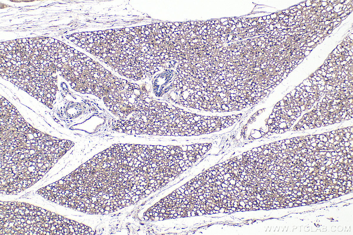 Immunohistochemical analysis of paraffin-embedded rat brown adipose tissue slide using 25424-1-AP (PLEKHF2 antibody) at dilution of 1:300 (under 10x lens). Heat mediated antigen retrieval with Tris-EDTA buffer (pH 9.0). IHC staining of rat brown adipose using 25424-1-AP