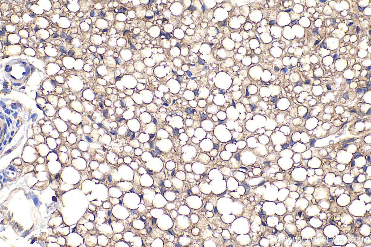 Immunohistochemical analysis of paraffin-embedded rat brown adipose tissue slide using 25424-1-AP (PLEKHF2 antibody) at dilution of 1:300 (under 40x lens). Heat mediated antigen retrieval with Tris-EDTA buffer (pH 9.0). IHC staining of rat brown adipose using 25424-1-AP