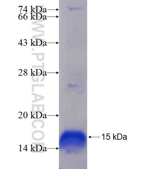 PLEKHG2 fusion protein Ag24287 SDS-PAGE PLEKHG2 fusion protein Ag24287 SDS-PAGE