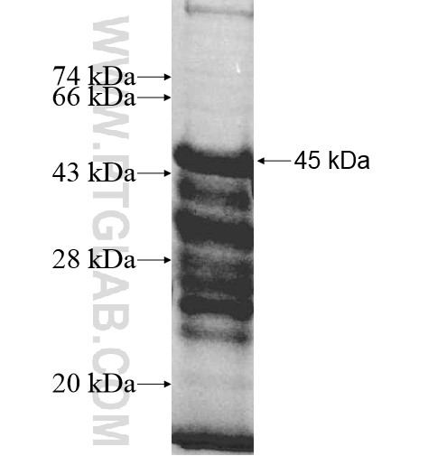 PLEKHG2 fusion protein Ag10463 SDS-PAGE PLEKHG2 fusion protein Ag10463 SDS-PAGE