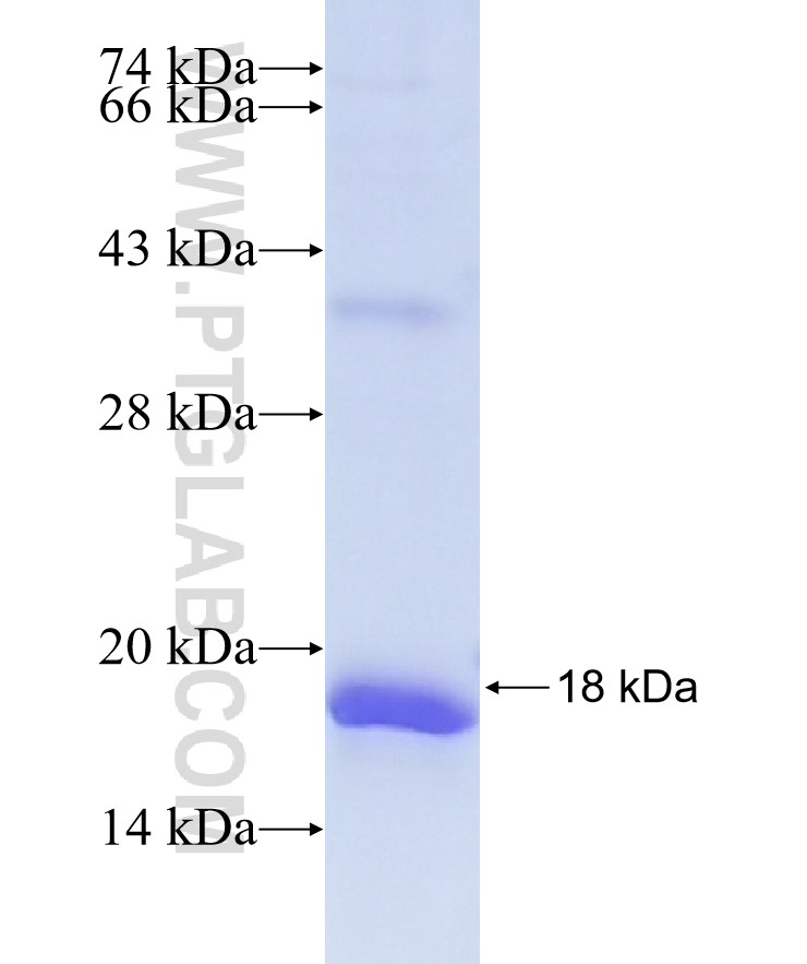PLEKHG3 fusion protein Ag40593 SDS-PAGE PLEKHG3 fusion protein Ag40593 SDS-PAGE