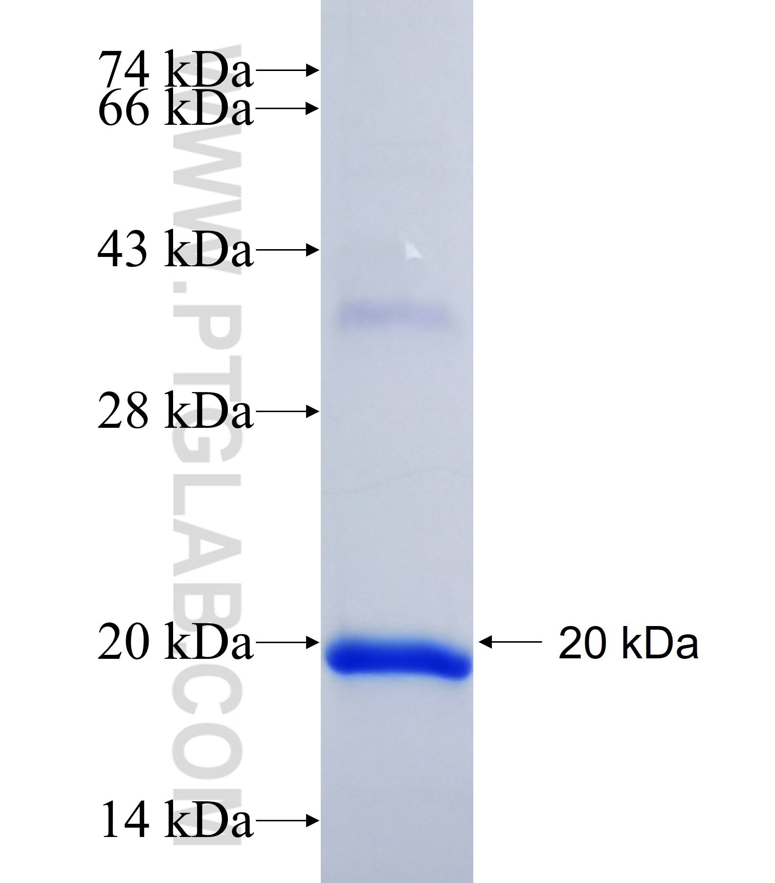 PLEKHG4B fusion protein Ag36704 SDS-PAGE PLEKHG4B fusion protein Ag36704 SDS-PAGE