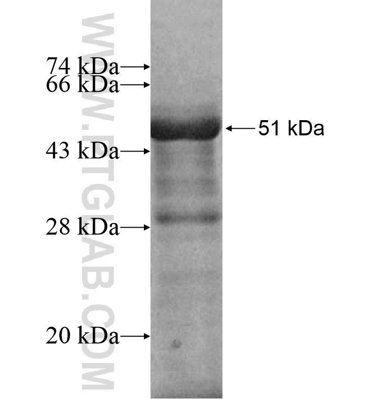 PLEKHG6 fusion protein Ag16575 SDS-PAGE PLEKHG6 fusion protein Ag16575 SDS-PAGE