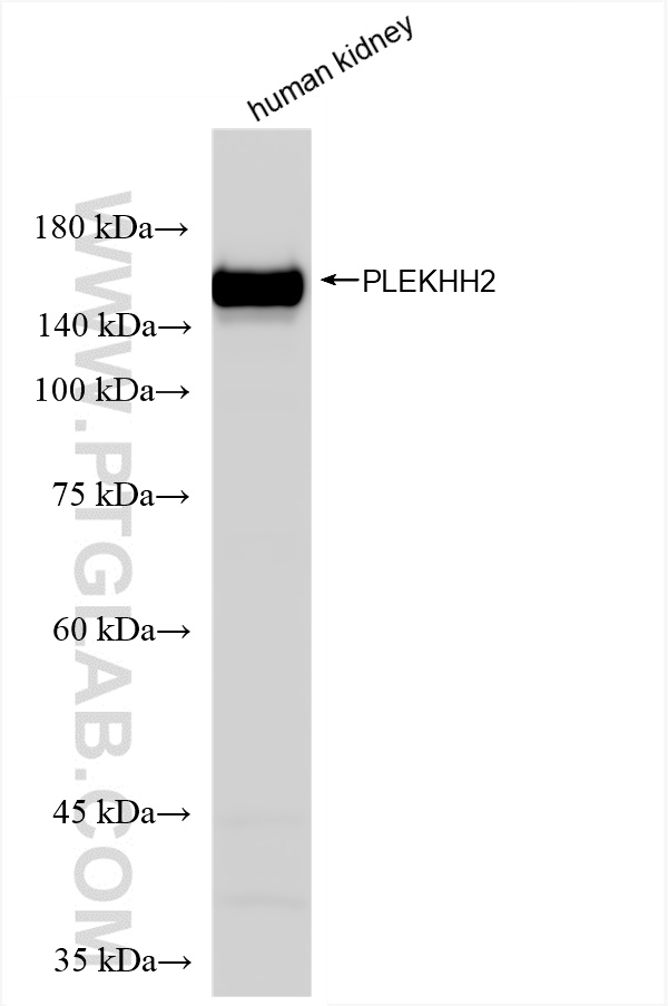 WB analysis of human kidney using 86166-3-RR