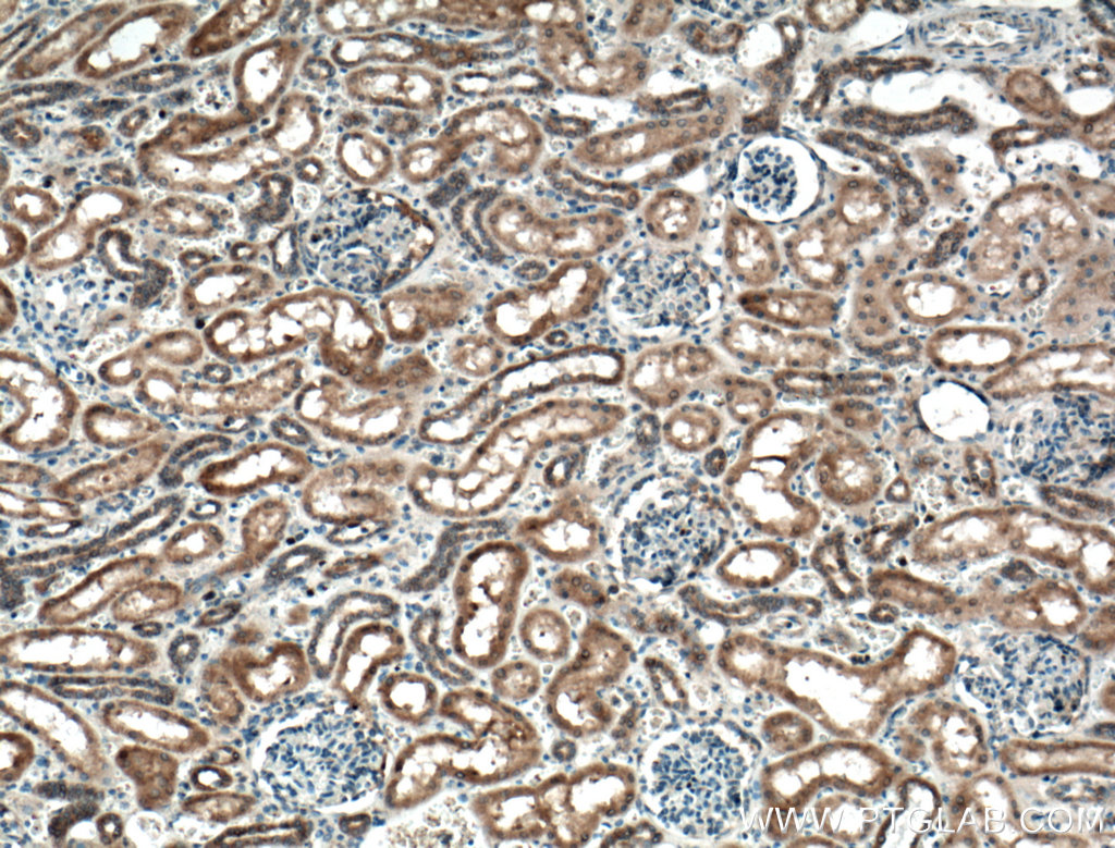 IHC staining of human kidney using 16202-1-AP