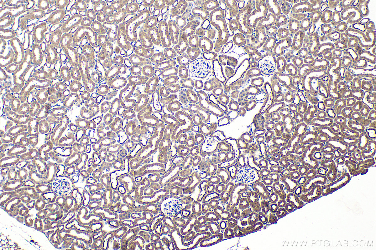 Immunohistochemical analysis of paraffin-embedded mouse kidney tissue slide using 16202-1-AP (PLEKHM1 antibody) at dilution of 1:200 (under 10x lens). Heat mediated antigen retrieval with Tris-EDTA buffer (pH 9.0). IHC staining of mouse kidney using 16202-1-AP