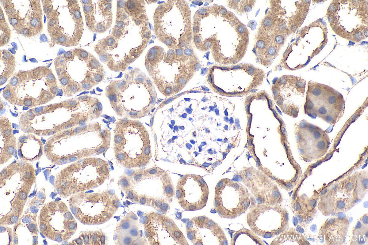 Immunohistochemical analysis of paraffin-embedded mouse kidney tissue slide using 16202-1-AP (PLEKHM1 antibody) at dilution of 1:200 (under 40x lens). Heat mediated antigen retrieval with Tris-EDTA buffer (pH 9.0). IHC staining of mouse kidney using 16202-1-AP