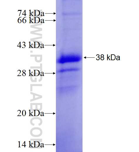 PLEKHM1 fusion protein Ag9150 SDS-PAGE PLEKHM1 fusion protein Ag9150 SDS-PAGE