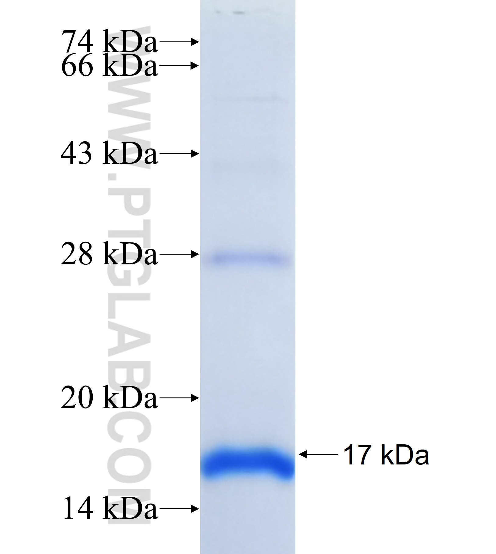 PLEKHM2 fusion protein Ag41226 SDS-PAGE PLEKHM2 fusion protein Ag41226 SDS-PAGE