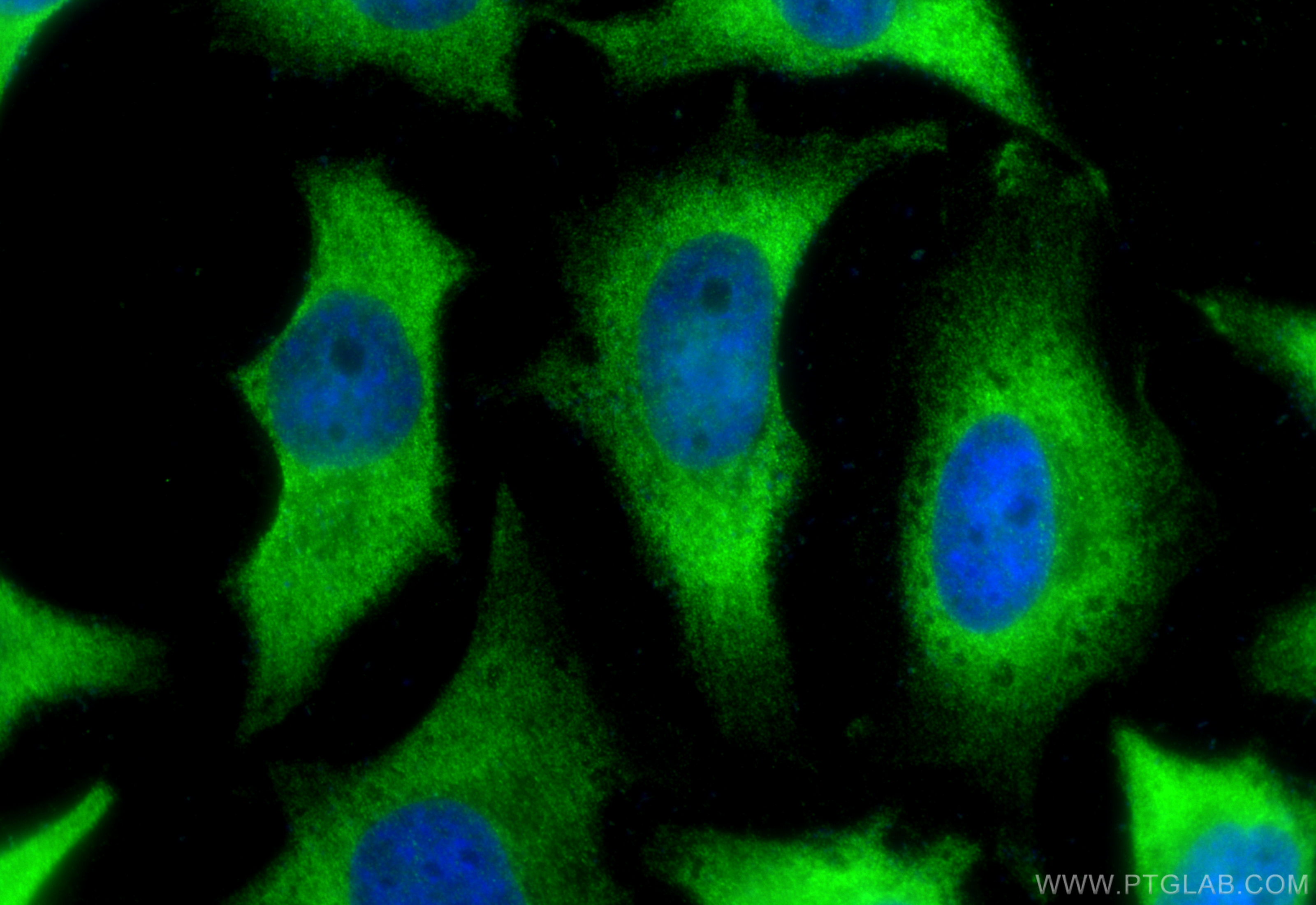 IF Staining of HeLa using 21356-1-AP