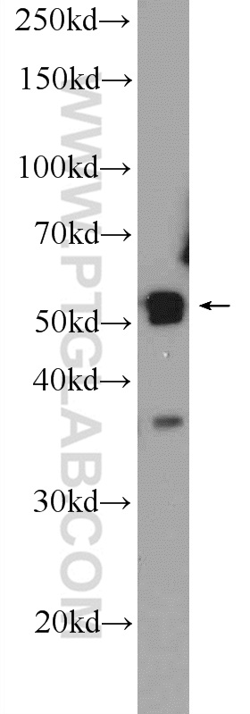 WB analysis of HeLa using 21356-1-AP