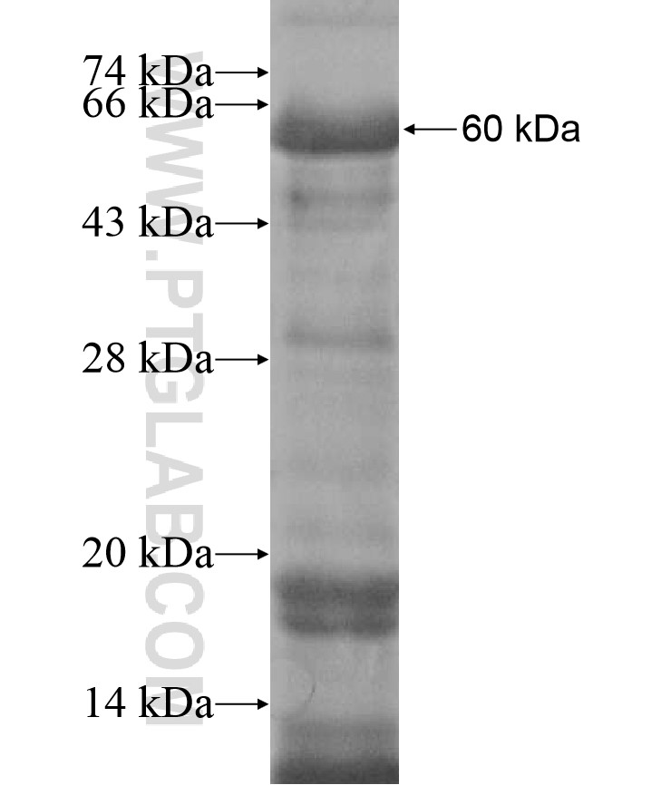 PLEKHO2 fusion protein Ag16965 SDS-PAGE PLEKHO2 fusion protein Ag16965 SDS-PAGE