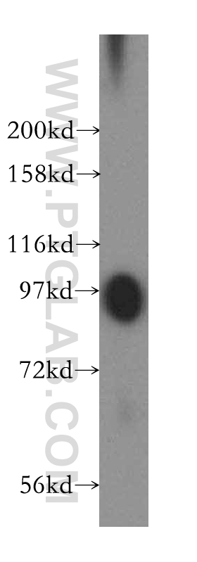 Plasminogen Polyclonal antibody