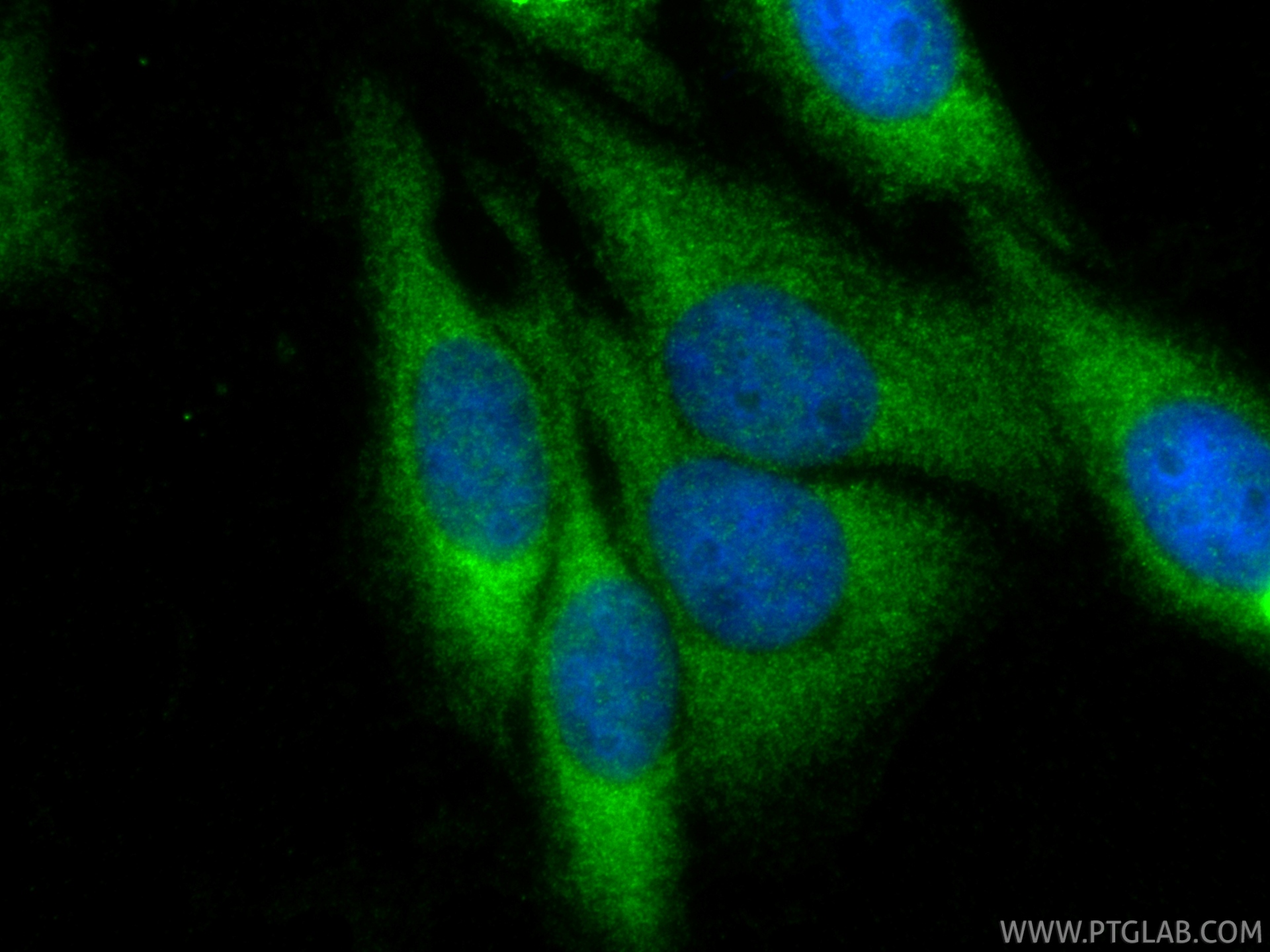 IF Staining of HepG2 using 17462-1-AP IF Staining of HepG2 using 17462-1-AP