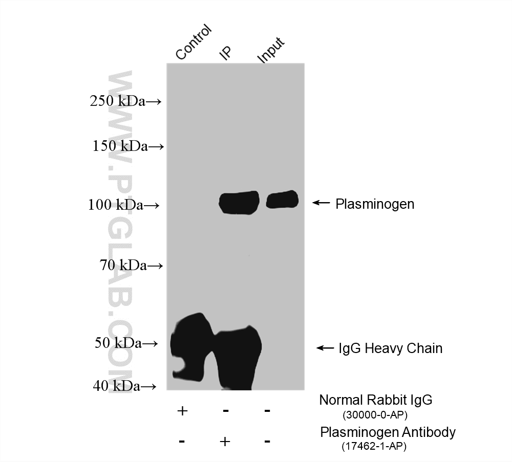 IP experiment of human plasma using 17462-1-AP IP experiment of human plasma using 17462-1-AP