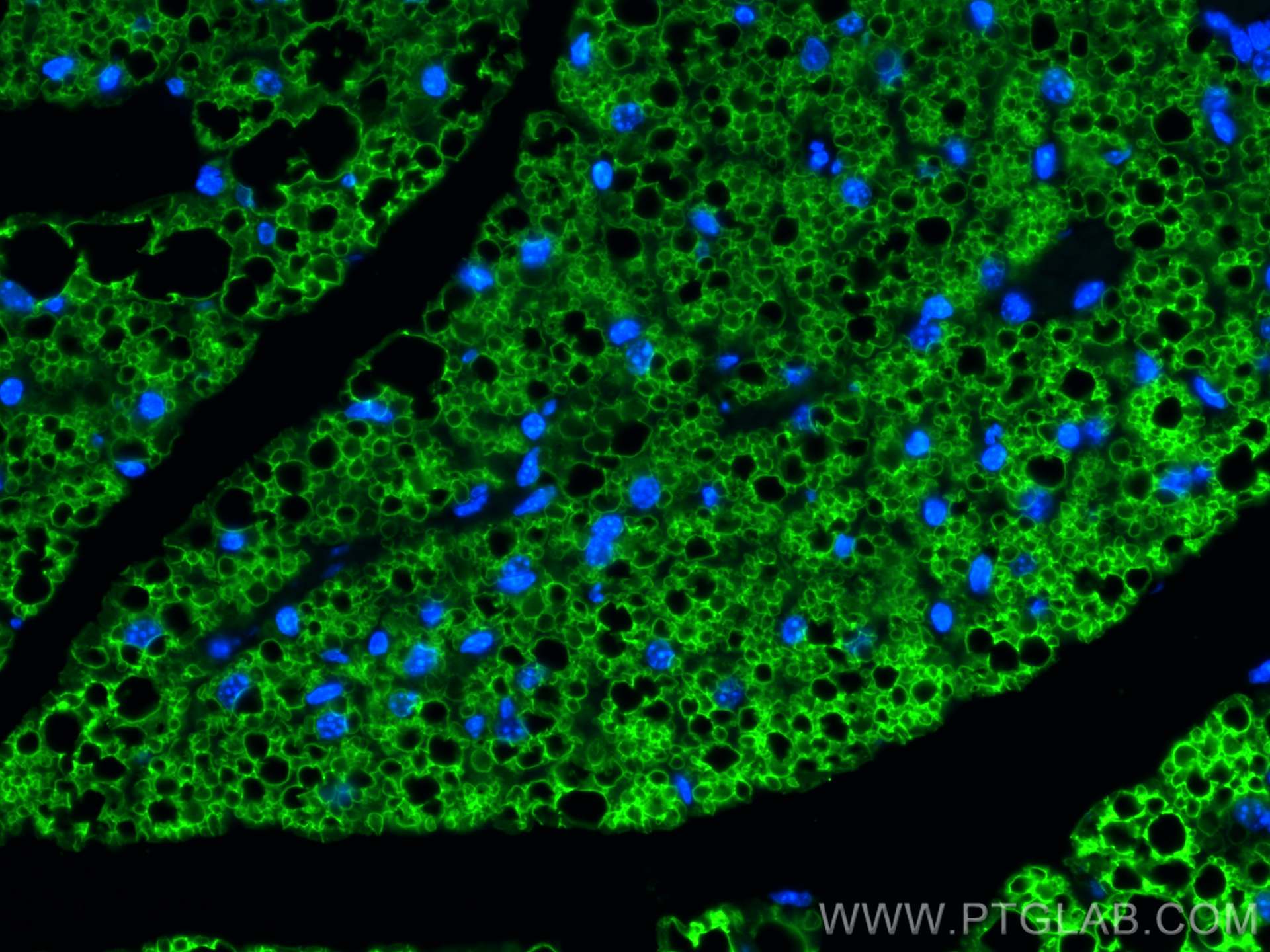IF Staining of mouse brown adipose using 27716-1-AP