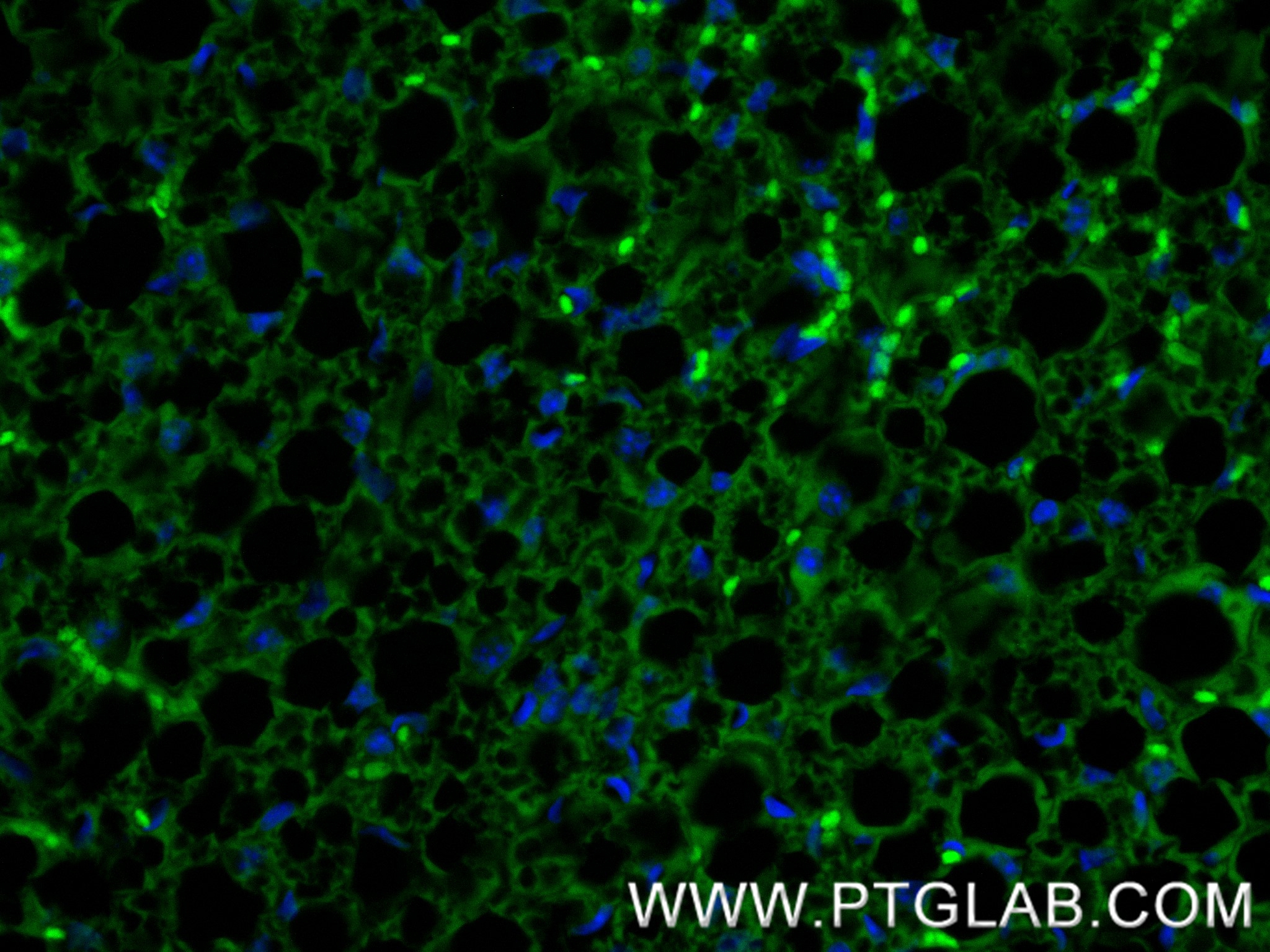 IF Staining of mouse brown adipose using 83905-4-RR IF Staining of mouse brown adipose using 83905-4-RR