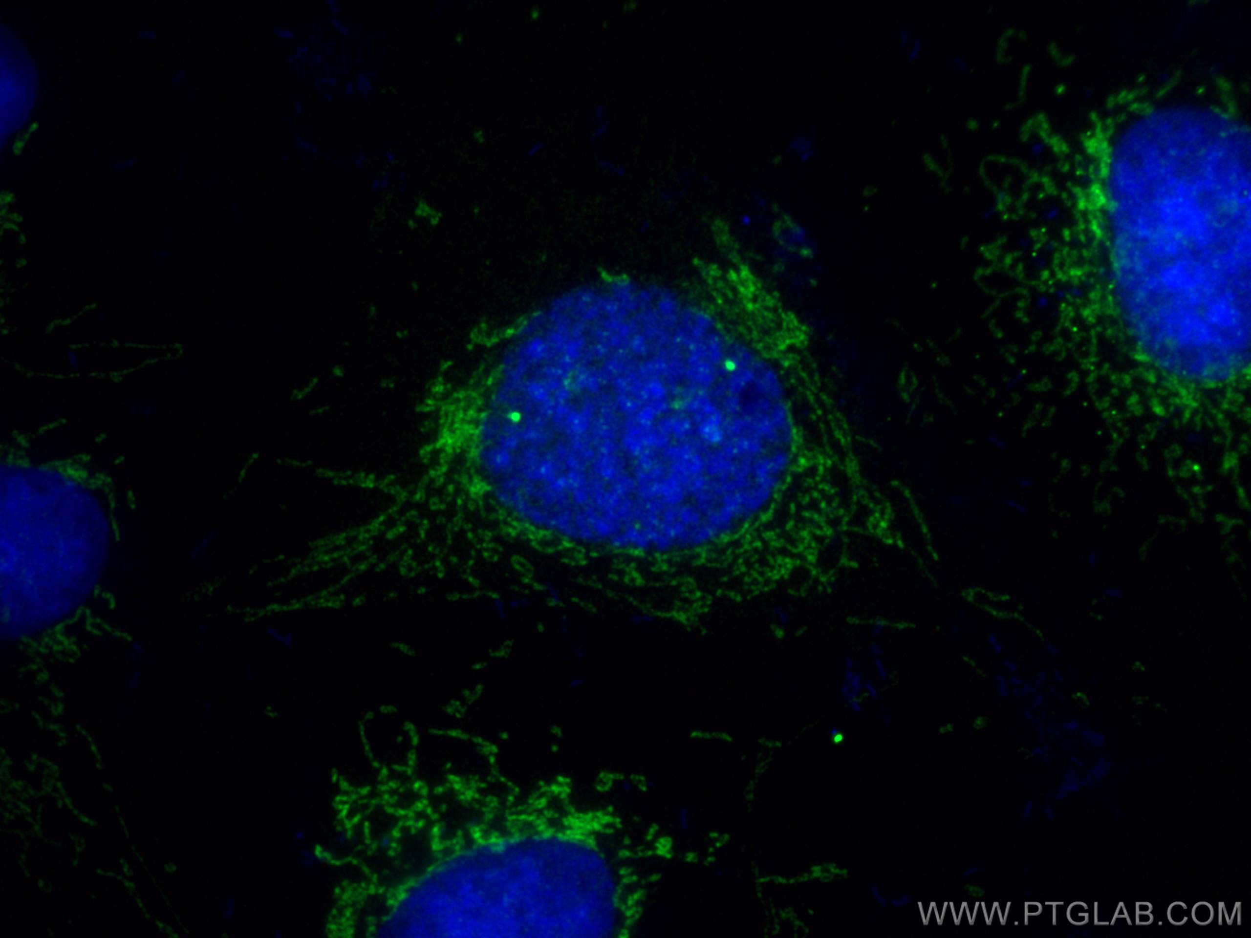 IF Staining of U2OS using 10305-1-AP