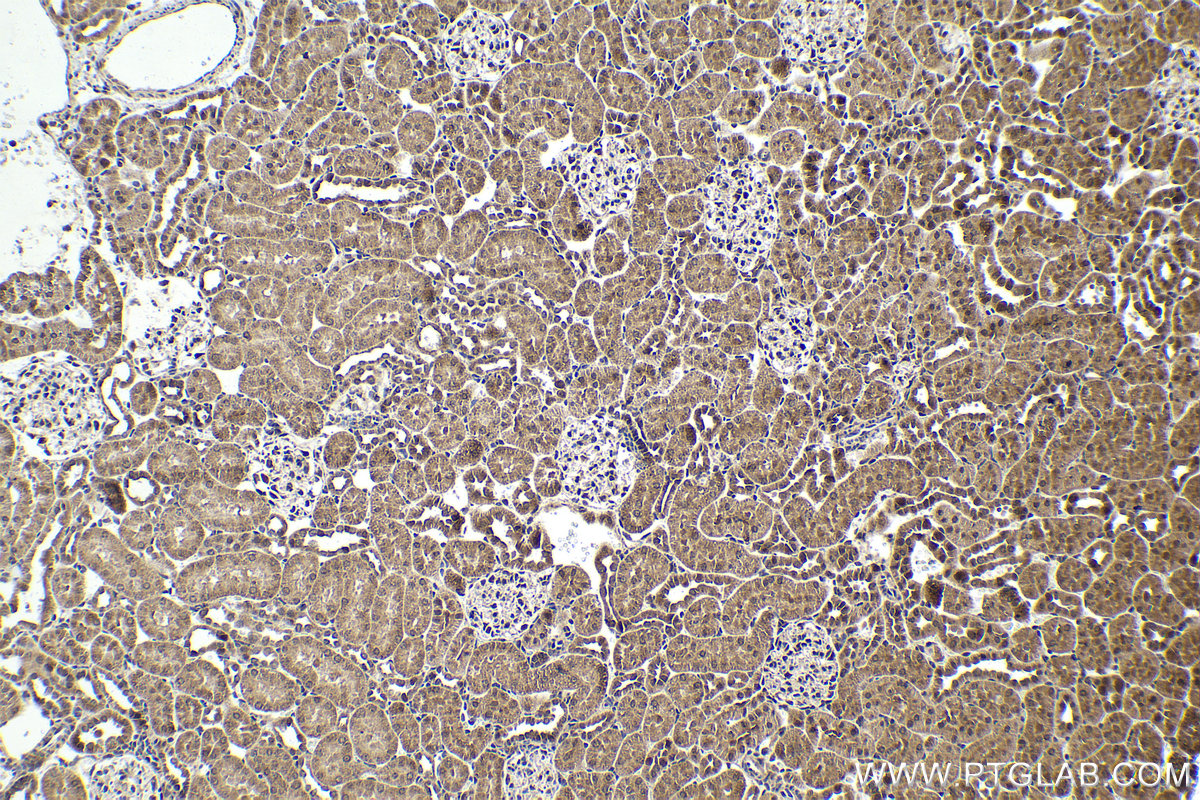 IHC staining of rat kidney using 10305-1-AP